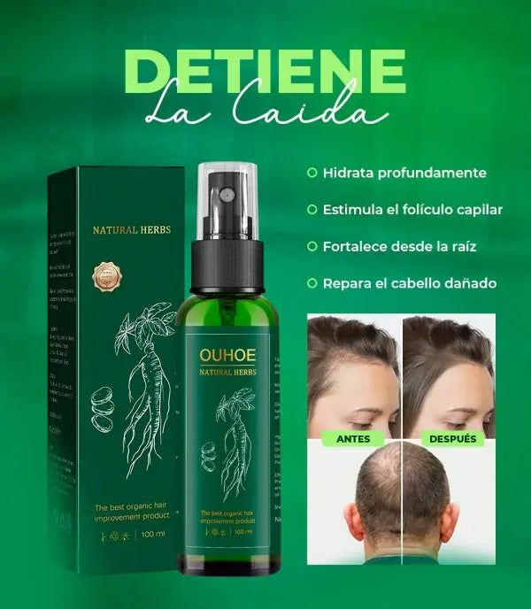 Ouhoe® Tonico Para El Crecimiento Capilar