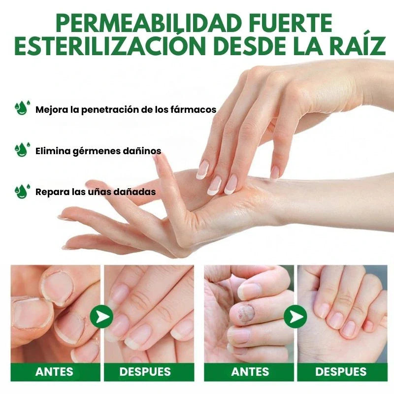 7 Days Fungus Free Nails® - Protege y elimina el hongo de tus Uñas.